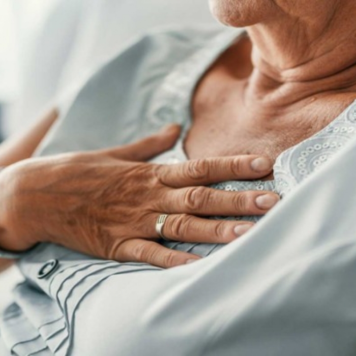 THC Pills A New Rx For Chest Pain MCDSA